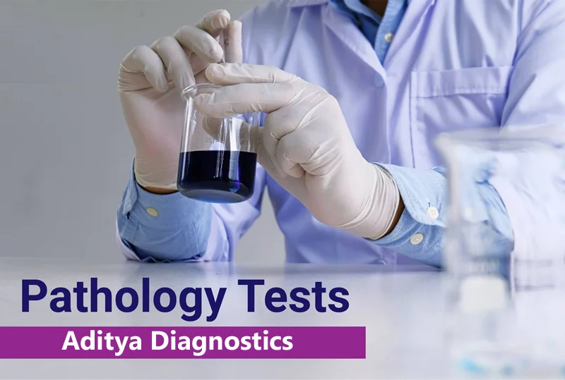 Pathology-Lab Tests